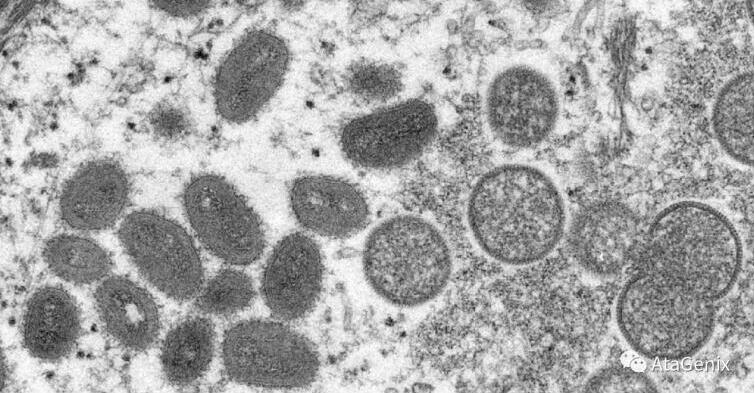 Proteínas del Virus de la viruela del mono recombinante de Sekbio