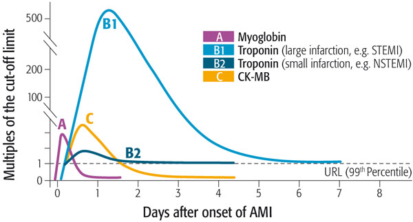 Myo: el primer marcador de proteína cardíaca anormalmente aumentado después de una lesión Miocárdica